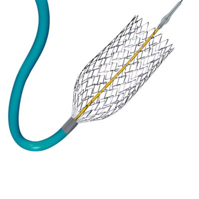 carotid stent expanding stents cordis endovascular impact intervene precise