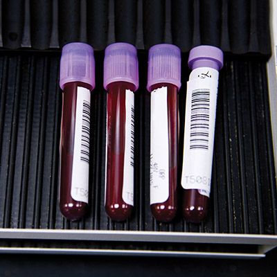 Vials of blood.