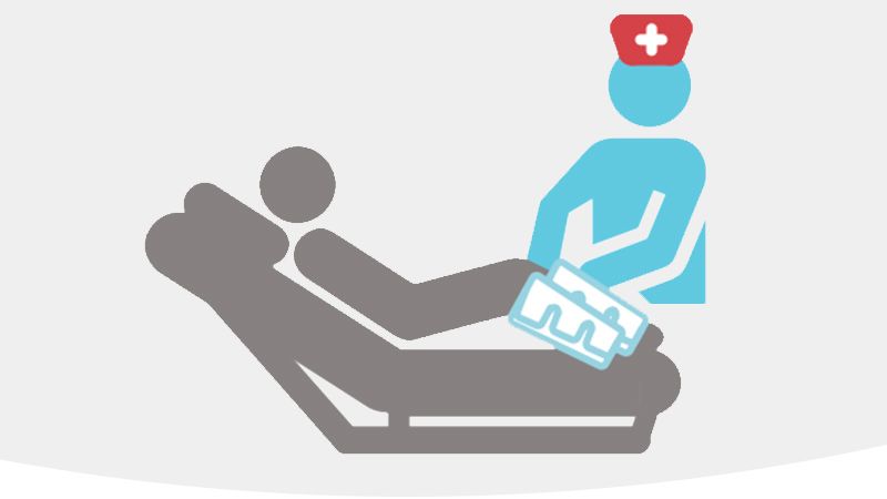 DVT Prevention: Intermittent Pneumatic Compression