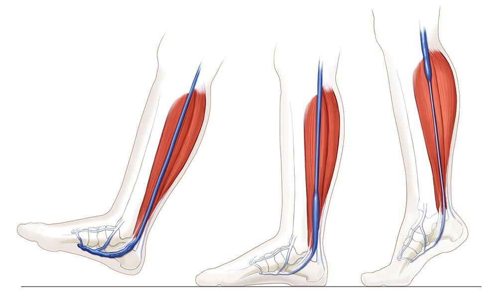 AV Impulse™ Foot Compression System Cardinal Health
