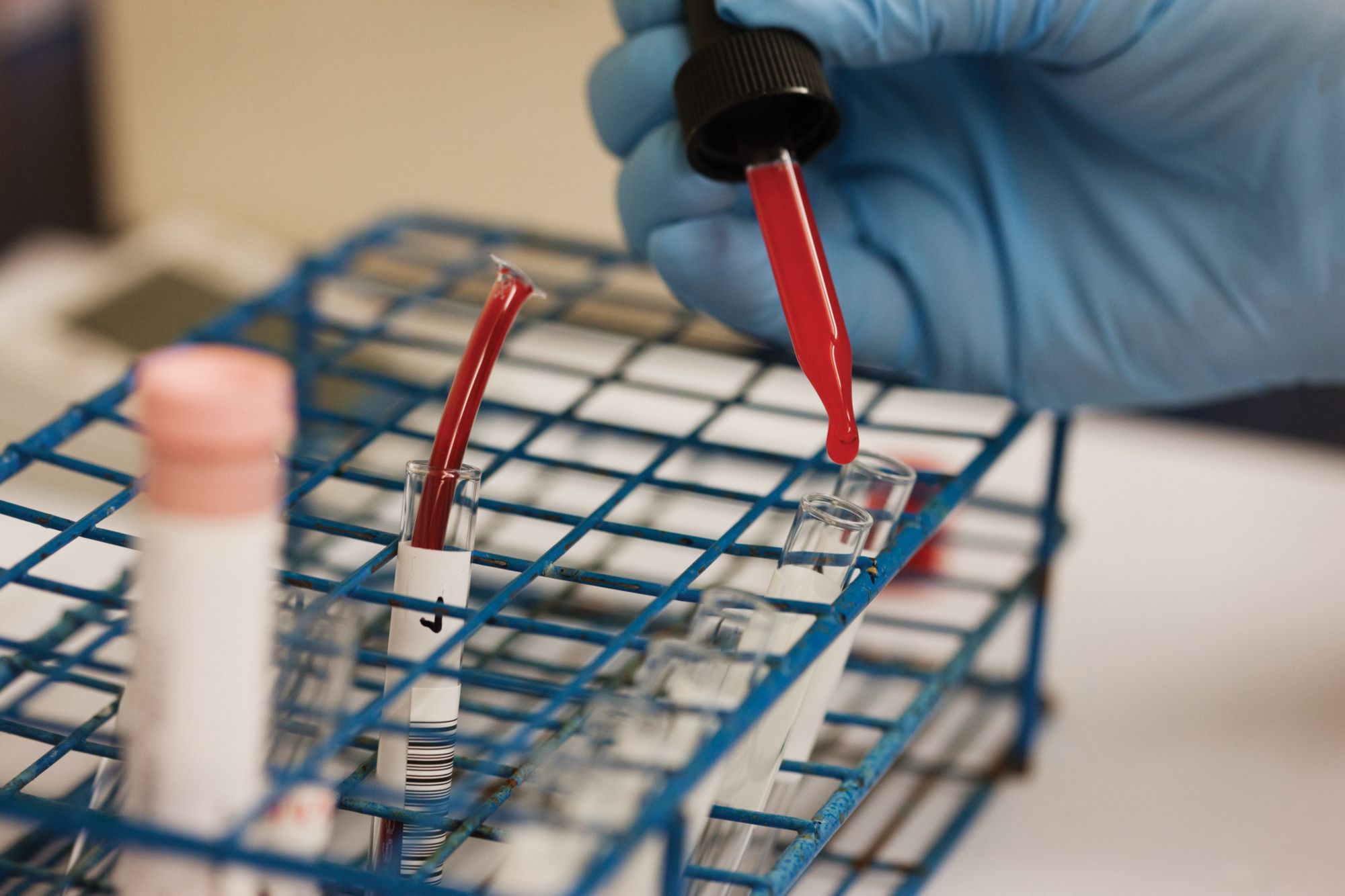 Realizing the potential of LC-MS