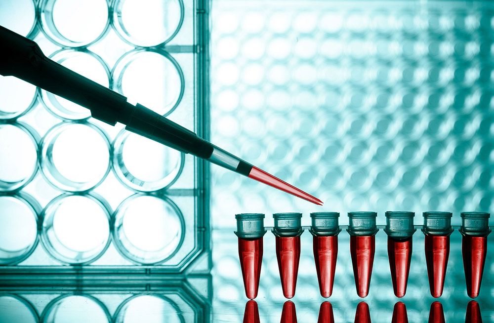 Laboratory Test Utilization; Improving and Reducing Costs