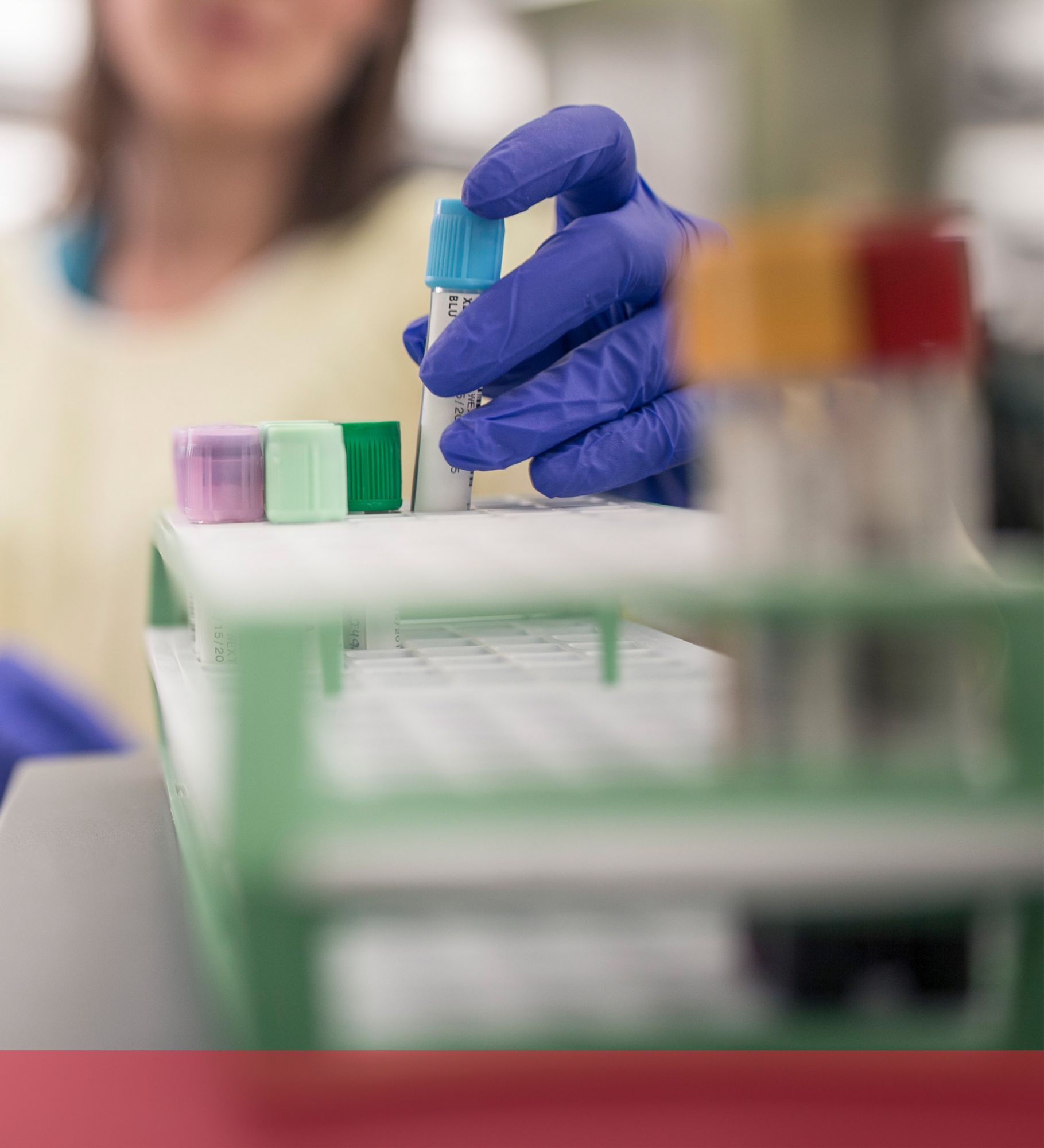 Blood Bank Automation From Manual To Full Automation: A Major Step